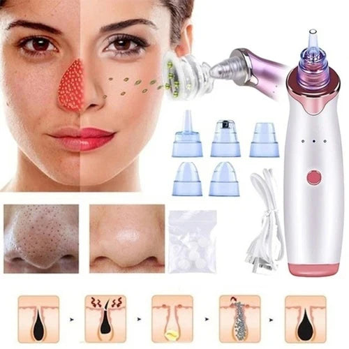 ✨ GlowSkin™ Portable Blackhead Remover ✨
