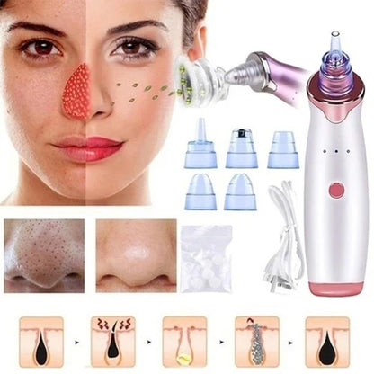 ✨ GlowSkin™ Portable Blackhead Remover ✨